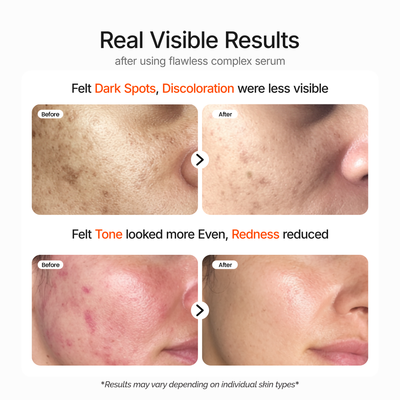 Niacinamide 10% Flawless Complex Serum